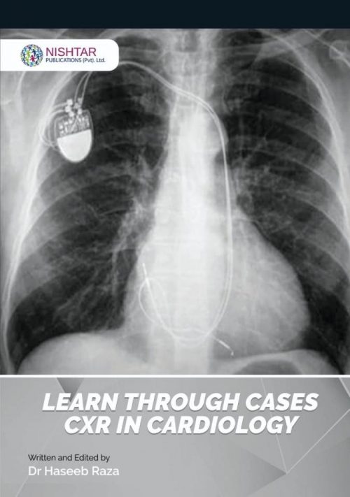Learn Through Cases CXR In cardiology