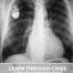 Learn Through Cases CXR In cardiology